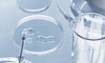 Laborbedarf: Eine Petrischale mit Flussigkeit und eine Reagenzglas-Pipette auf einem glatten Tisch.