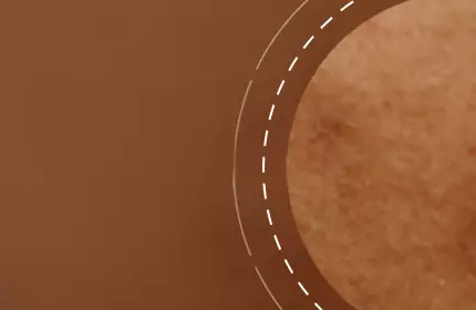 Close-up of skin with a smooth texture, featuring subtle variations in color and small imperfections set against a soft, earth-toned background.