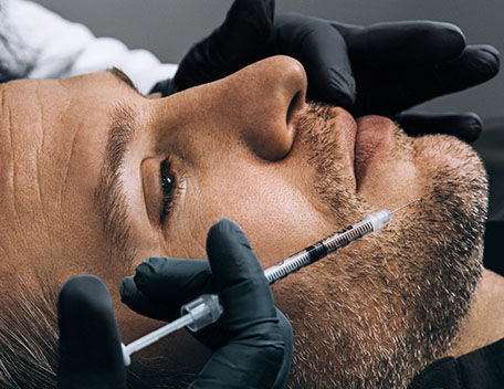 Adult Acne + Scarring