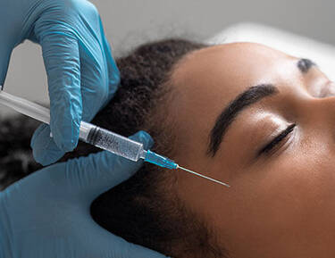 Adult Acne + Scarring