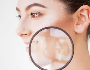 se-debarasser-des-taches-brunes-sur-le-visage