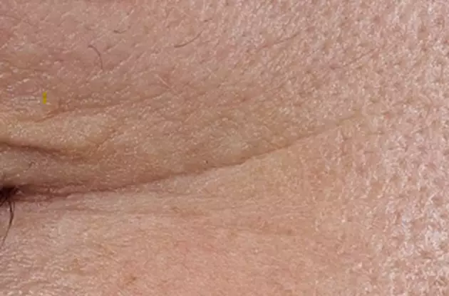 Gros plan sur la peau d'un visage, montrant des textures, des pores et des ridules.