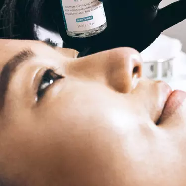 peeling chimique superficiel