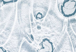 Close-up of abstract, textured surface with organic shapes, resembling ice or glass, in shades of blue and white.