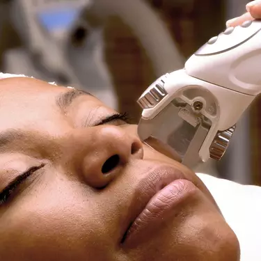 ultherapy lifting facial