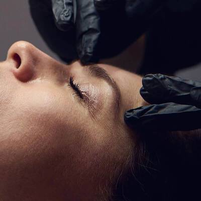 microneedling aquagold