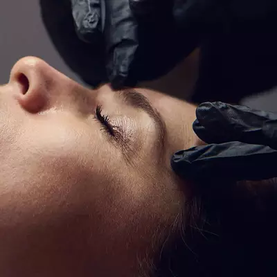 microneedling aquagold