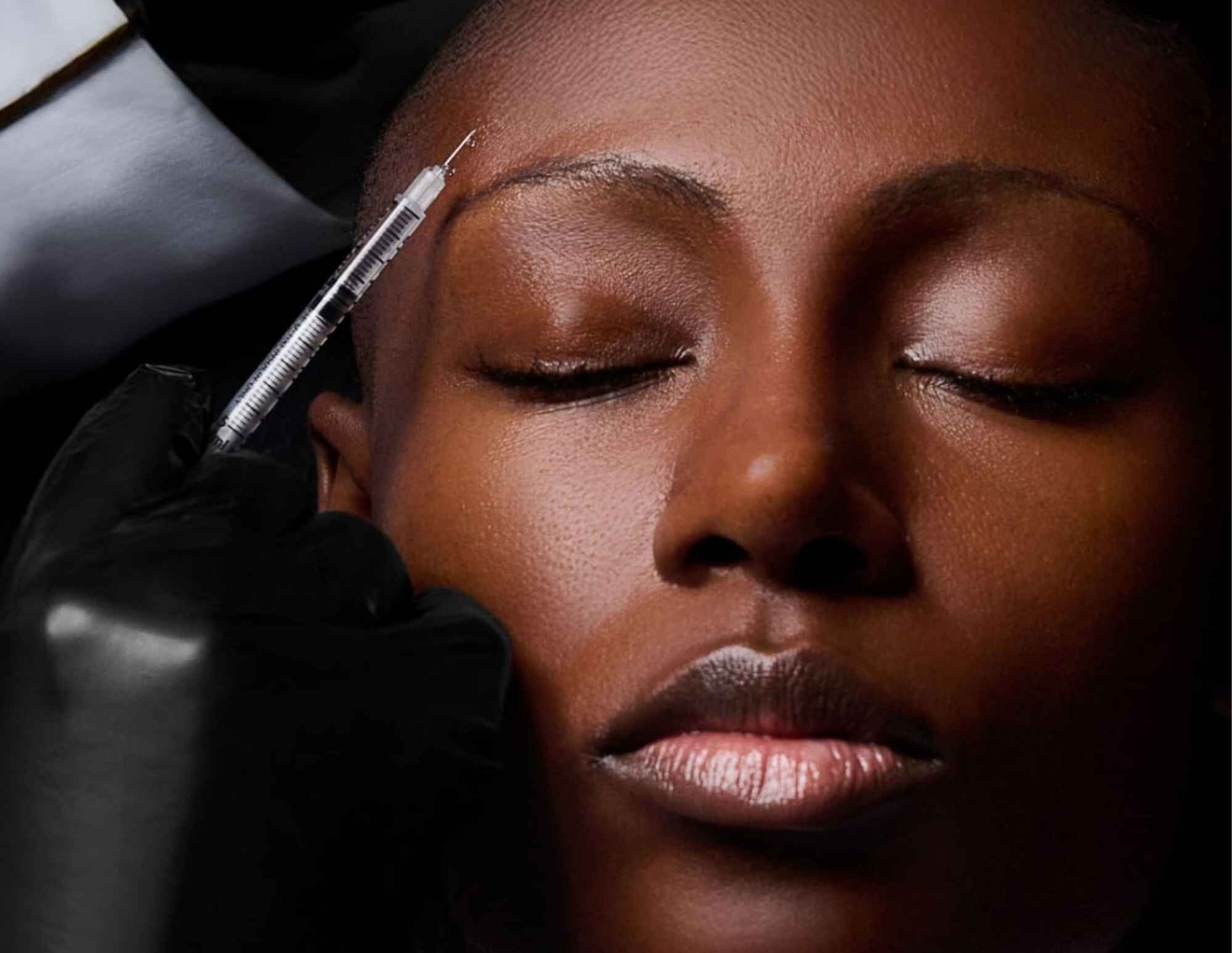 Femme se faisant injecter des neurotoxines sur le visage
