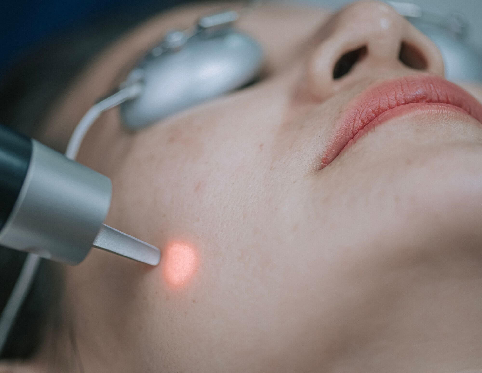 Booster son collagene avec des gestes simples et une routine beaute adaptee