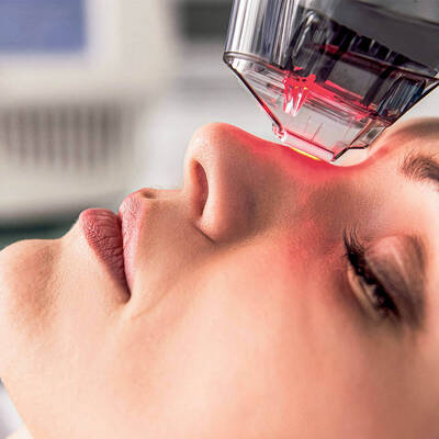 laser non ablatif