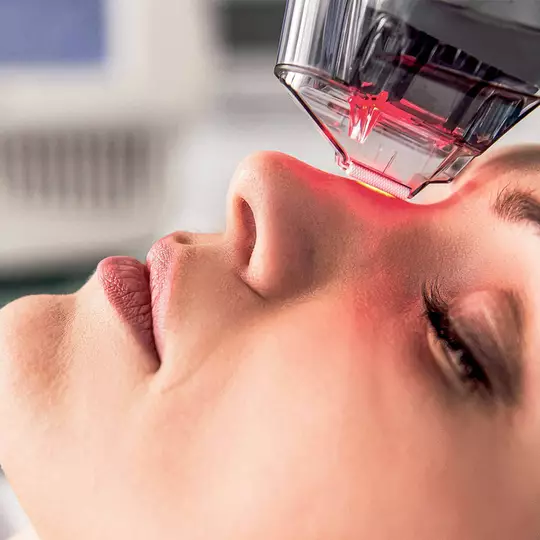 laser non ablatif