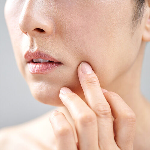 comment-faire-disparaitre-les-ridules