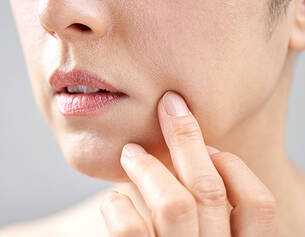 comment-faire-disparaitre-les-ridules