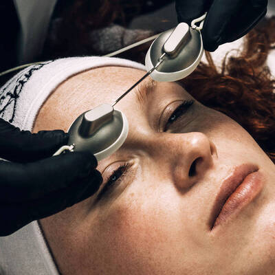 lumiere intense pulsee IPL traitement