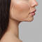 Comment enlever les
cicatrices d’acne ?