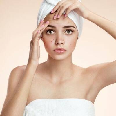 Une jeune femme avec une serviette sur la tete touche son visage, presentant des imperfections cutanees, dans un eclairage doux.
