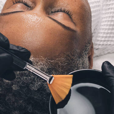 peeling chimique profond