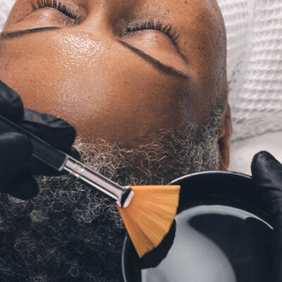 peeling chimique profond visage