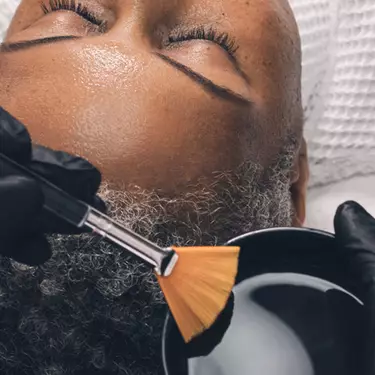 peeling chimique profond