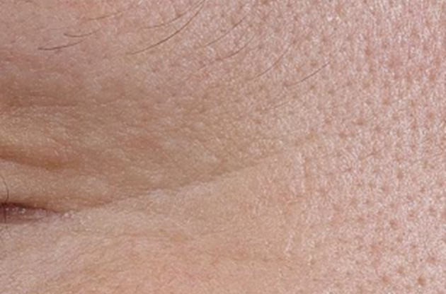 Detail de la peau humaine montrant des pores et des ridules pres d'un oeil.