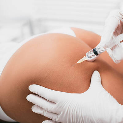 injection collagenase Clostridium cellulite fesses