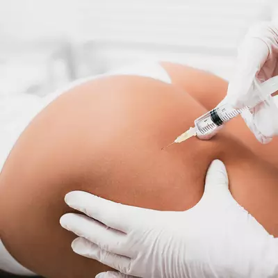 injection collagenase Clostridium cellulite fesses