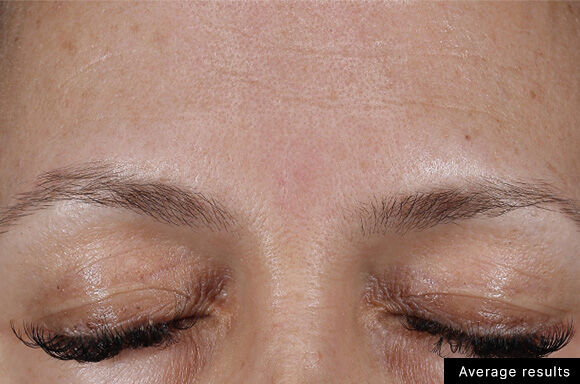 Une vue rapprochee d'un front feminin avec des sourcils fins et des cils longs, montrant une peau claire et legere.