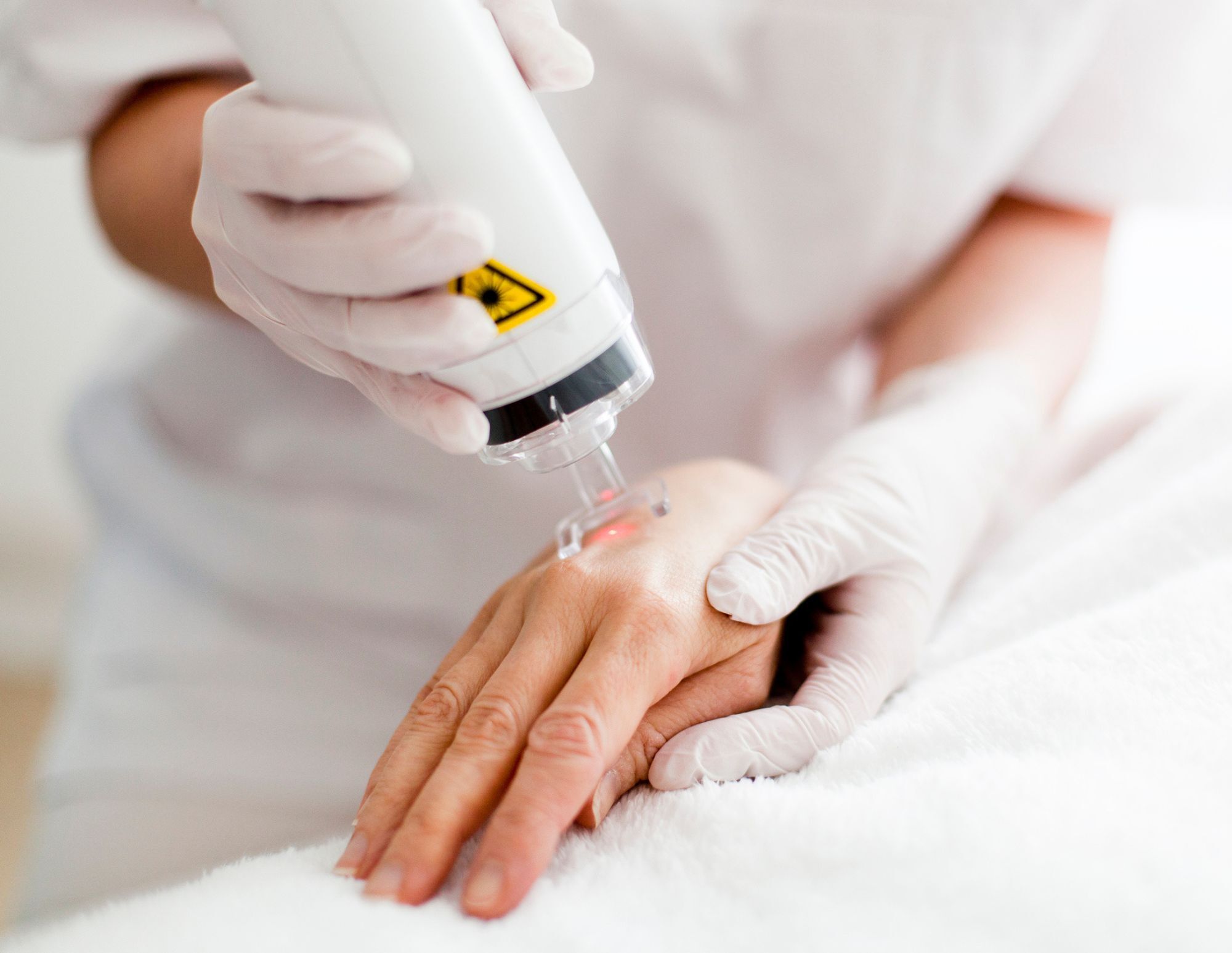Une main de patient recoit un traitement esthetique avec un appareil en cours d'utilisation par un professionnel en gants.