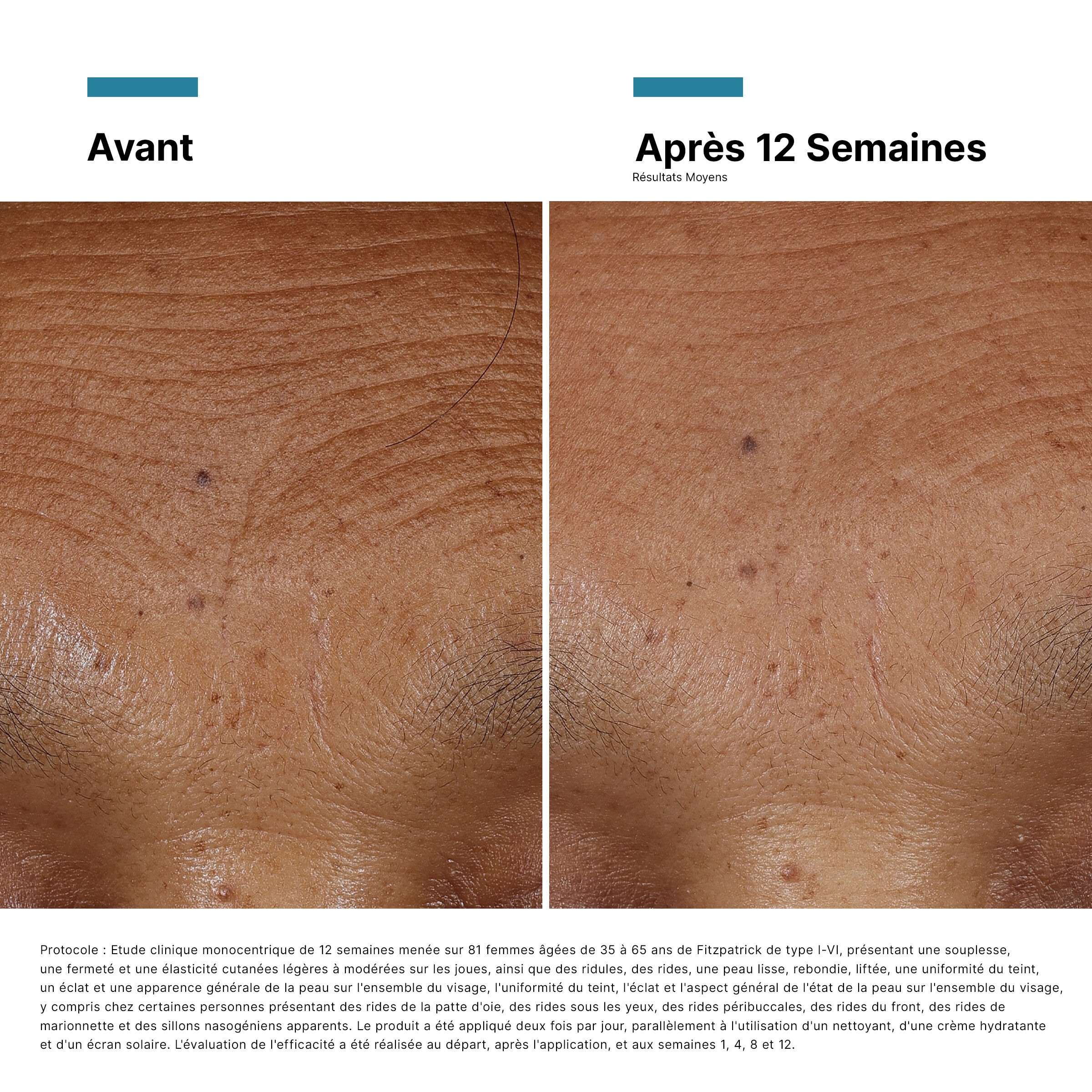HA Intensifier Multi-Glycan