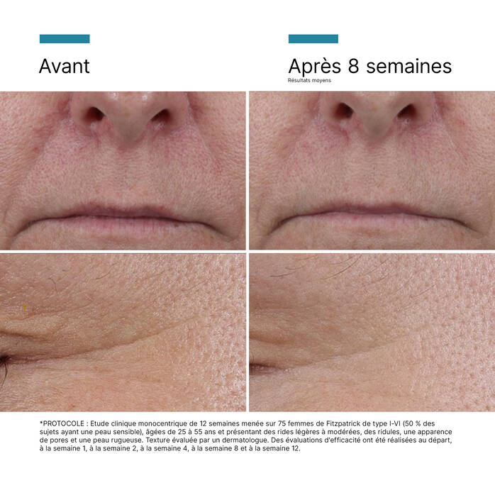 P-TIOX Sérum Correcteur de Rides | SkinCeuticals