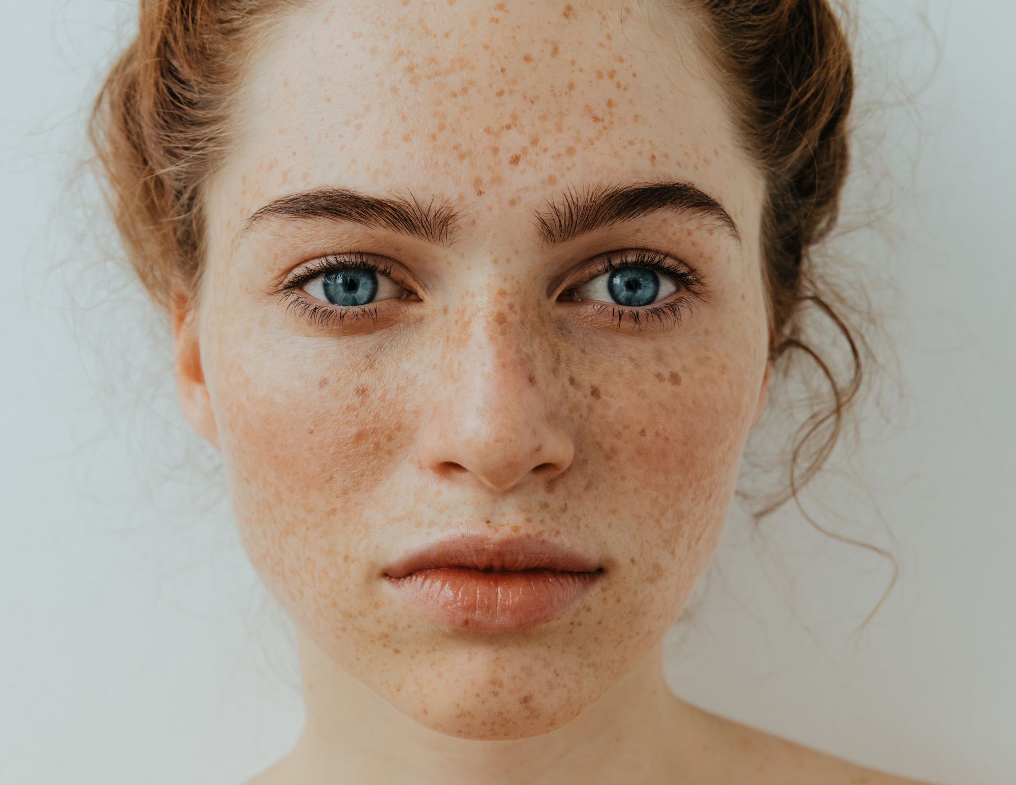 Crème Anti-Imperfections P-CARE - Contre Mélasma Et Hyperpigmentation, 15g