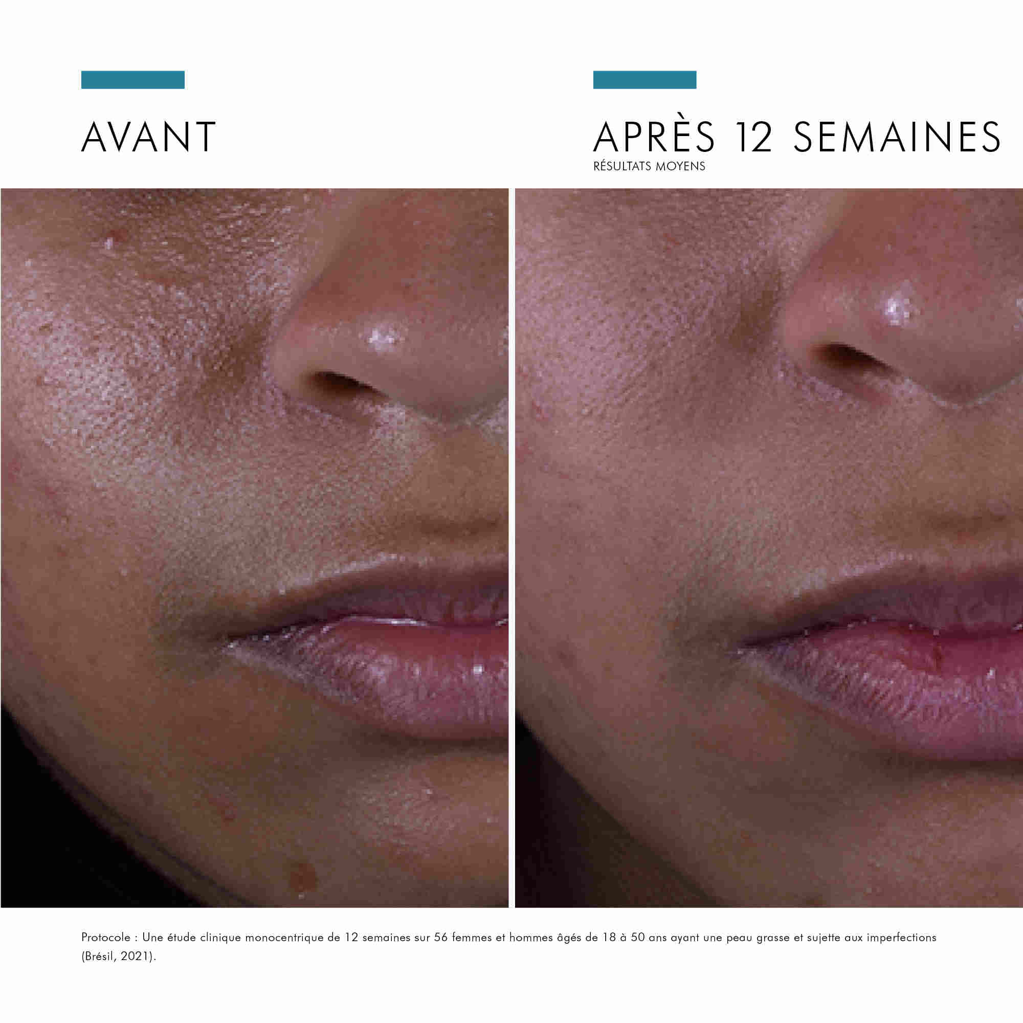 Silymarin_CF_avant_après